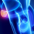 Overview on Prostate Cancer Types show