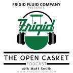 The Open Casket show