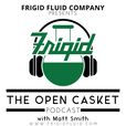 The Open Casket show