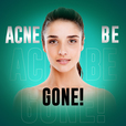 Acne Be Gone Podcast show
